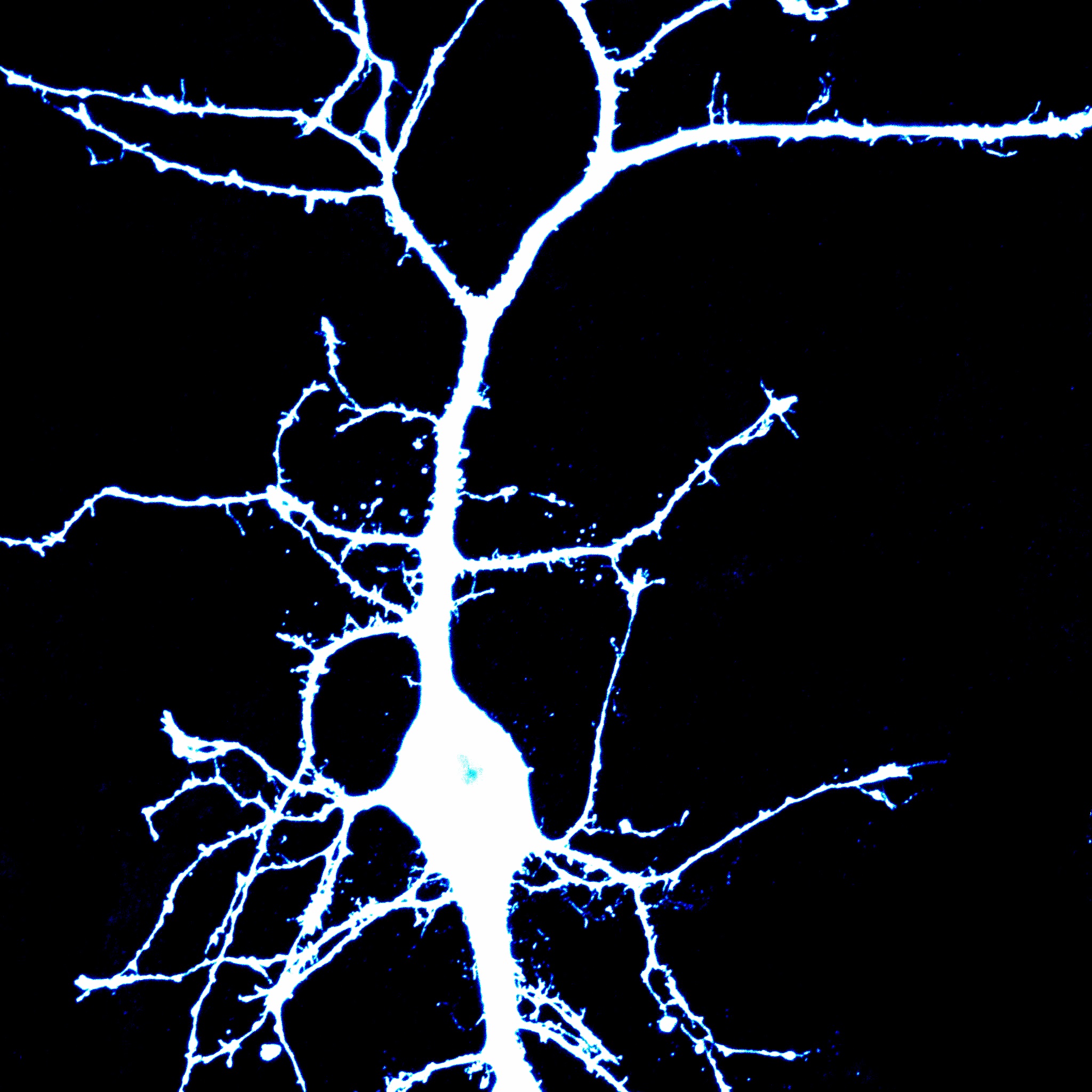 Icy_a_neuron.jpg